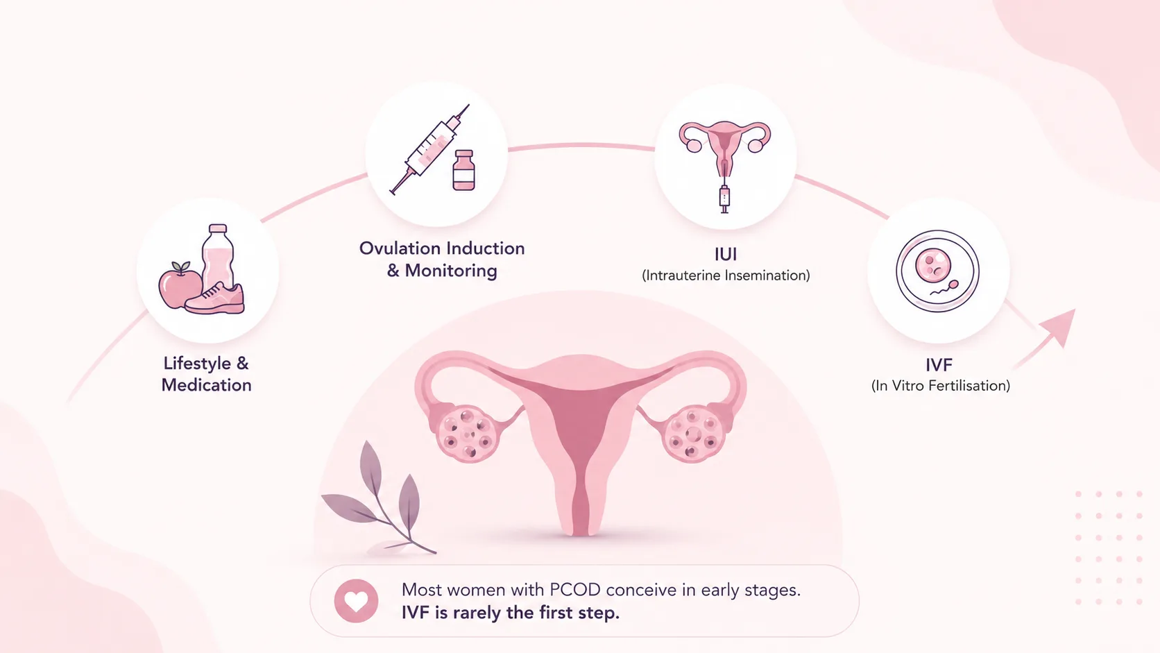 PCOD treatment in Delhi infographic showing stepwise fertility care from lifestyle and medication to ovulation induction, IUI, and IVF.