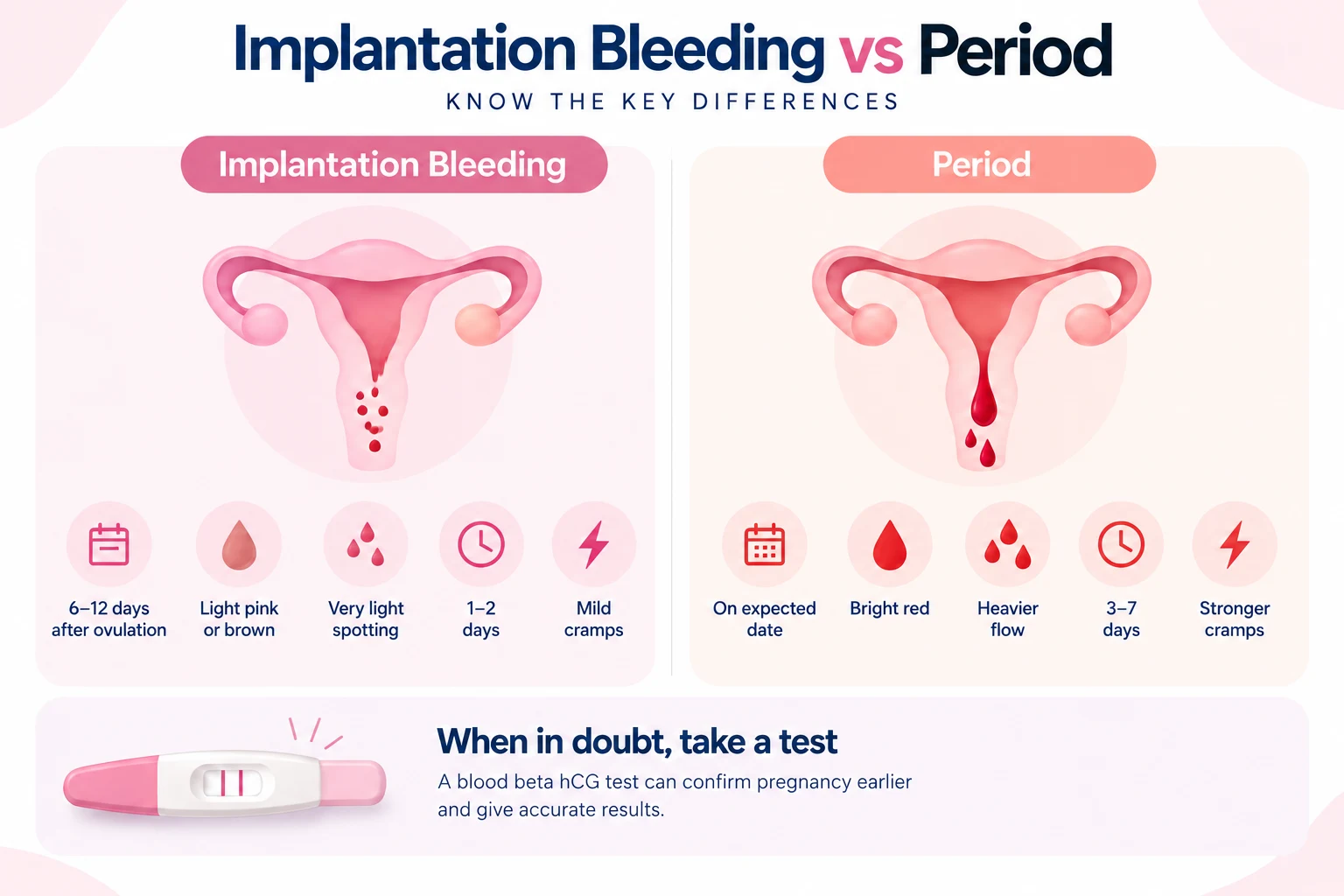Infographic comparing implantation bleeding and period by timing, color, flow, duration, and cramps
